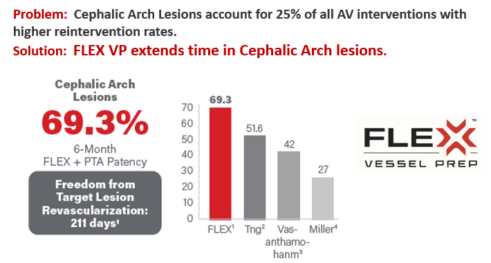 VMG_FLEX's tweet photo. #FLEXfirst in AV Access Management.  #avaccess #hemodialysis #cephalicarch https://t.co/OULZIN5a2M