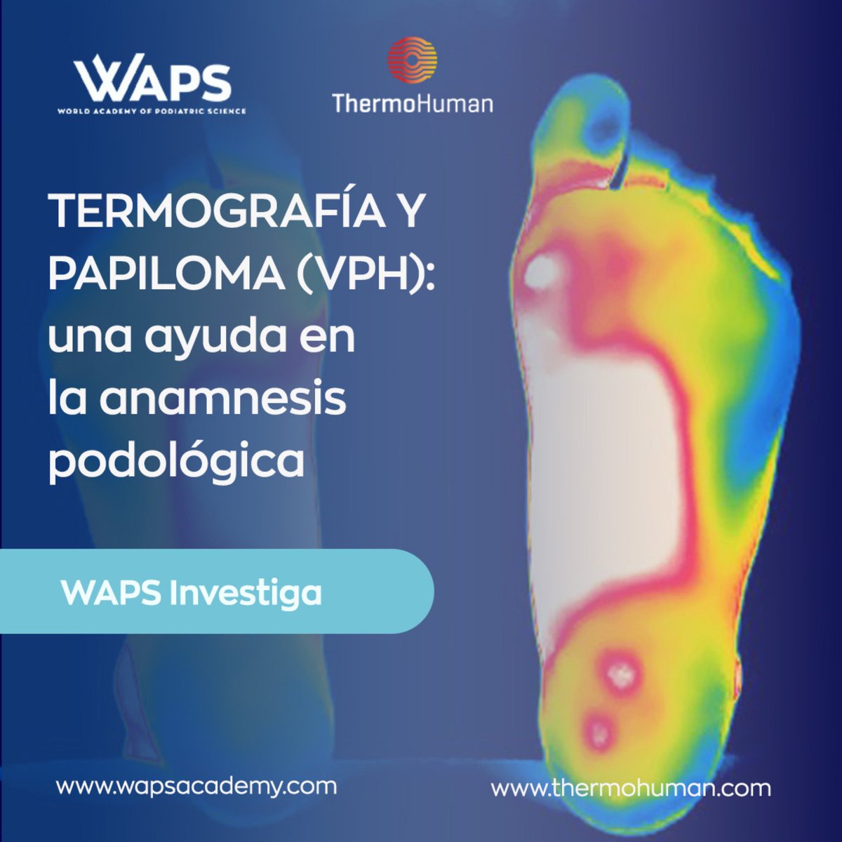🆕🦶 ¡WAPS &amp; @thermo_human en #WAPSInvestiga ! Identificar papilomas (#VPH) con #termografía en el pie del deportista.

👣 ¿Sabías que las verrugas plantares tienen una incidencia anual del 27% en la población que usa duchas comunes como los #deportistas? 

🔍 Analizando (…)