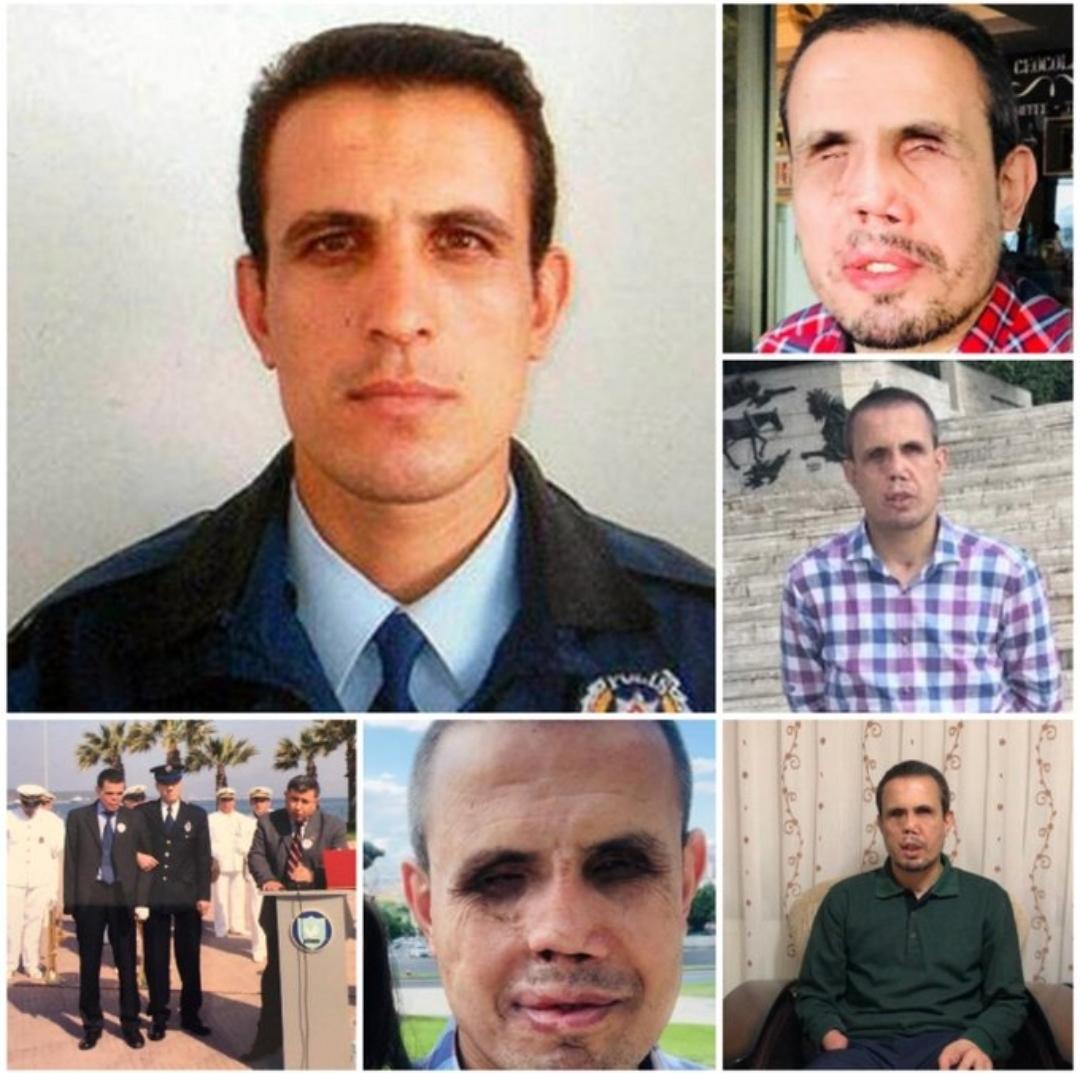 Aliağa İlçe Emniyet Müdürlüğü'nde bomba imha uzmanı olarak görev yaparken 5 Şubat 2009'da elinde bomba patlaması sonucu ağır yaralı olarak hastaneye kaldırılan Bilal Konakçı'nın %98 engelli ve şubat 2021'den beri TUTUKLU olduğunu biliyor musunuz?

#EytSonViraj
#OHALDevamEdiyor