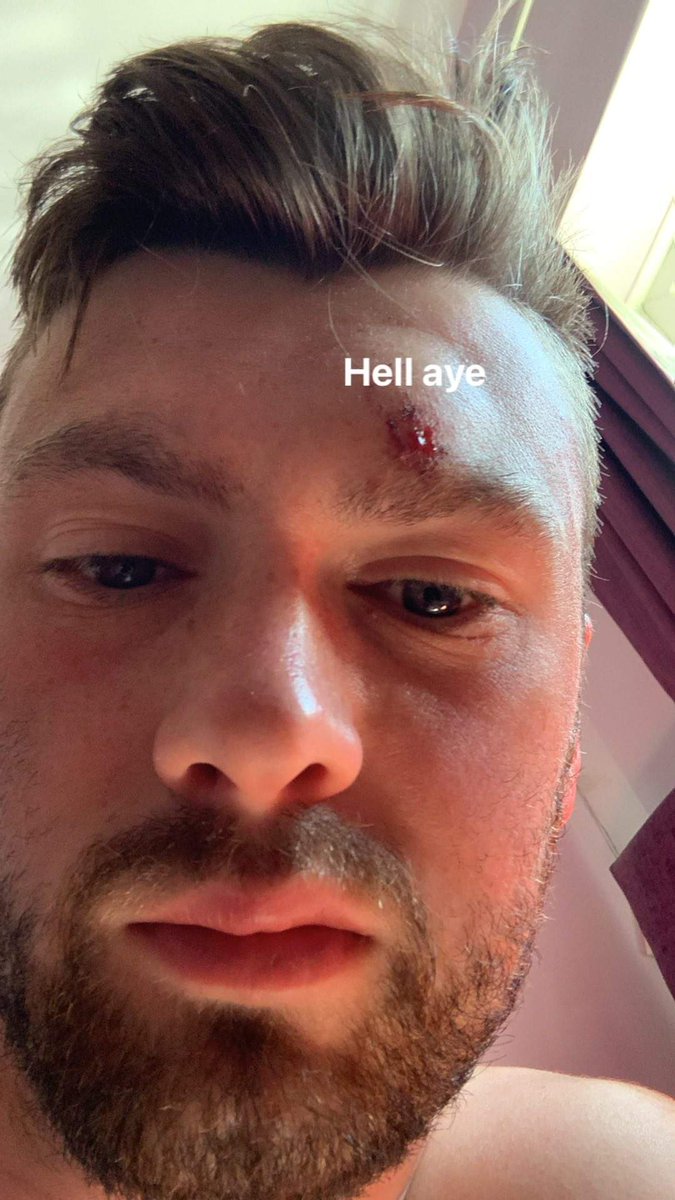 UpTheTeethFc's tweet photo. Full Time Result: Red Snappers 2-11 Borussia Teeth. It was very wet and we played the same team again. We beat them again because of course we did. Everyone scored. Everyone played well because you can't not. Don't know who we play next because it always changes. Meh. #UpTheTeeth https://t.co/bcS7h5csXZ