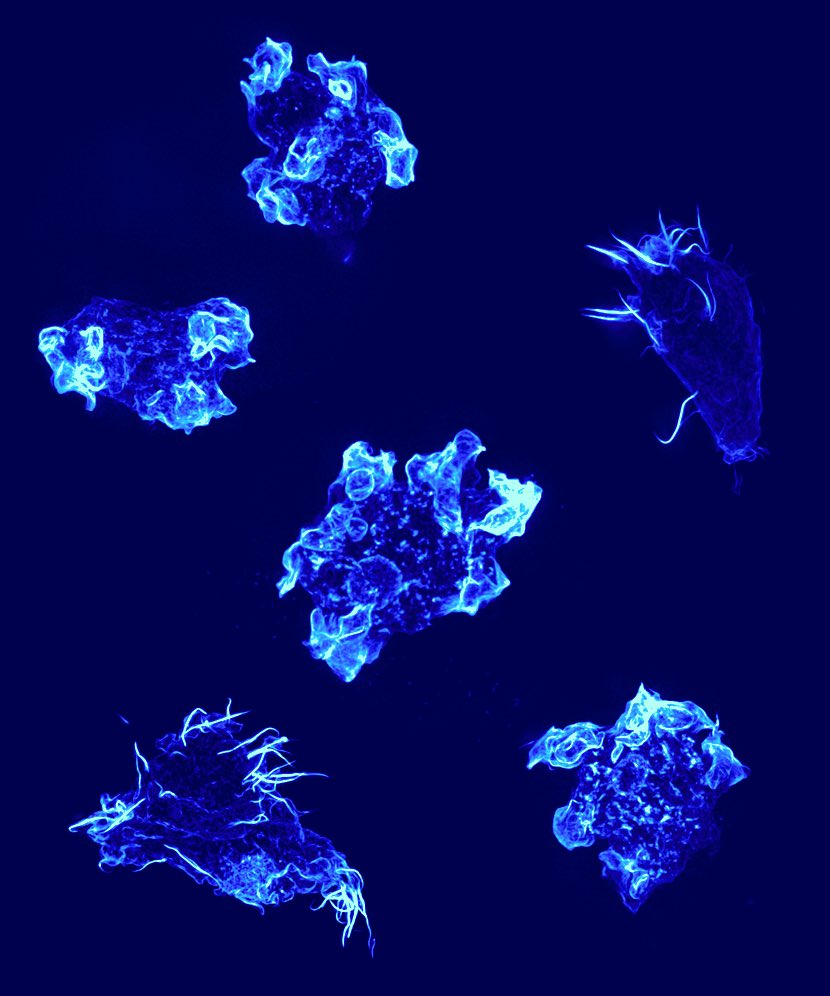 Happy #MicroscopyMonday! 
Here are some Naegleria amoebae stained for actin polymer.