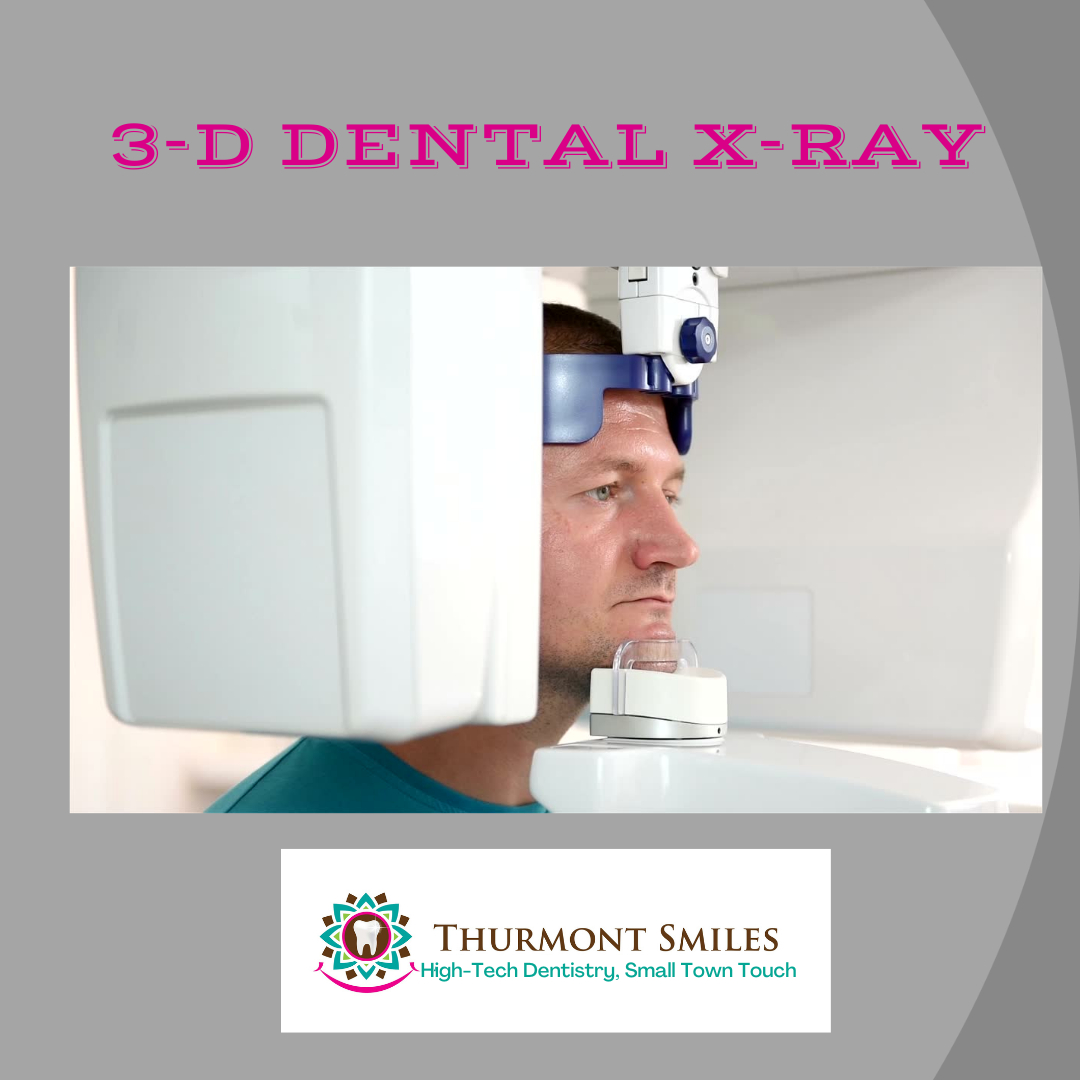 With the addition of CBCT 3-D x-rays, we are now one of the most technologically advanced dental practices in the country!
.
3-D X-Ray allows us to find "hidden" infections that go unnoticed on regular 2-D X-rays. I also use the 3-D x-rays to place completely digitally planned de