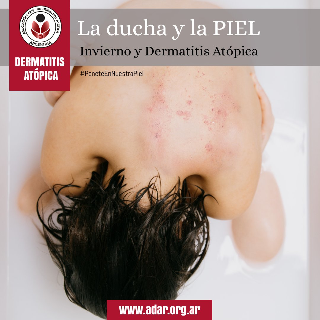 ADAR_oficial's tweet photo. ¿A quién no le gusta una ducha caliente en invierno?
Para las personas con DA es perjudicial, el agua muy caliente arrastra la poca grasitud natural que tiene nuestra piel.
#dermatitisatopica #pielsensible #pielseca #eccema #picazon #PoneteEnNuestraPiel
#invierno #pielatopica https://t.co/nJZk7Gh0sW