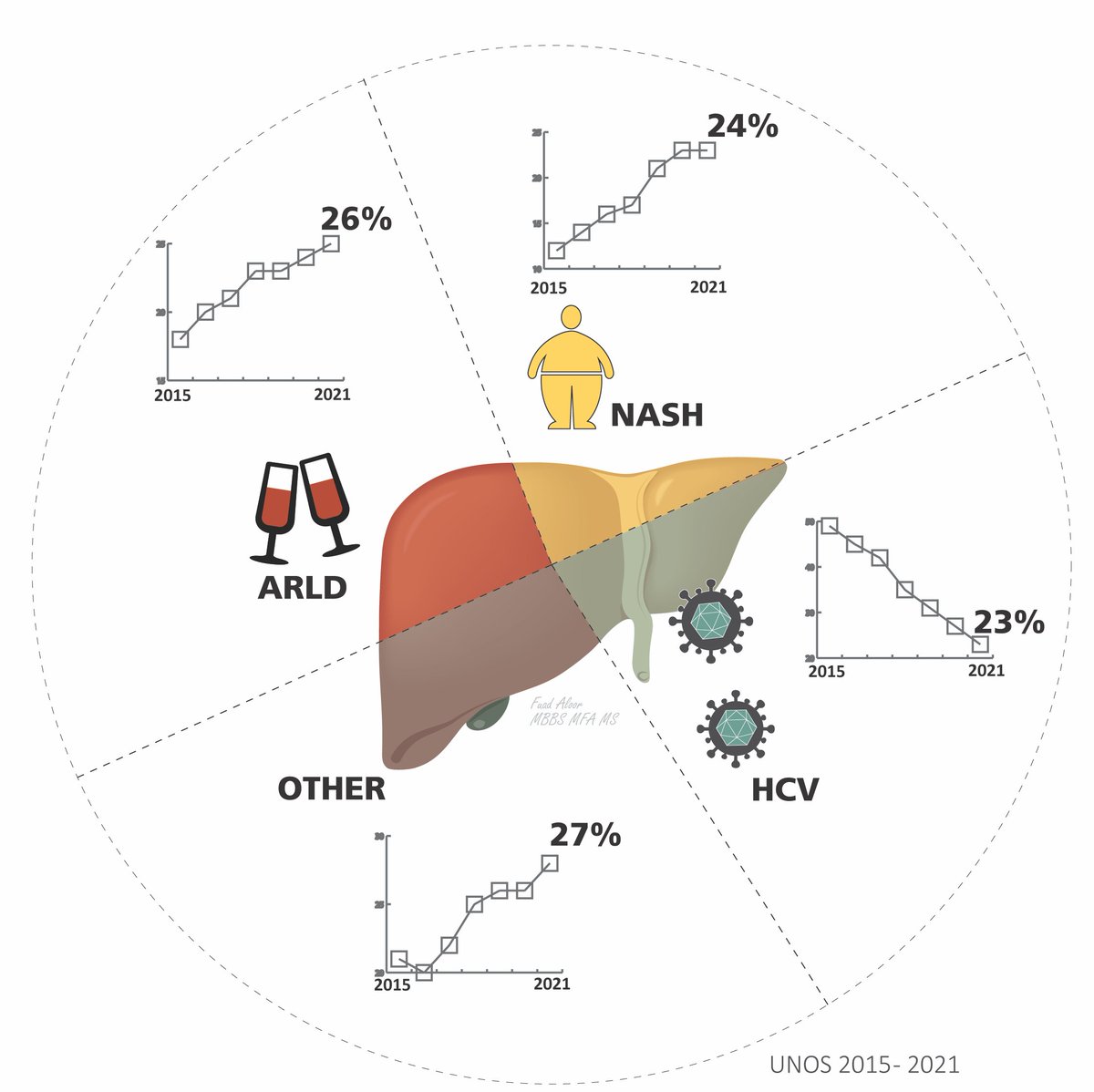 George Cholankeril (@gcholankeril) on Twitter photo Contemporary changes in etiology for hepatocellular carcinoma in liver transplantation
HCV dethroned but with rising burden from ALD/NASH
cghjournal.org/article/S1542-…
<a href="/fuadzain_MedArt/">Fuad Aloor</a> for the graphic!
<a href="/AGA_CGH/">CGH</a> <a href="/AnjiyaShaikh/">Anjiya Shaikh, MD</a> <a href="/SeragHashem/">Hashem el- Serag</a> <a href="/KanwalFasiha/">Fasiha Kanwal</a> #livertwitter #GITwitter Contemporary changes in etiology for hepatocellular carcinoma in liver transplantation
HCV dethroned but with rising burden from ALD/NASH
cghjournal.org/article/S1542-…
<a href="/fuadzain_MedArt/">Fuad Aloor</a> for the graphic!
<a href="/AGA_CGH/">CGH</a> <a href="/AnjiyaShaikh/">Anjiya Shaikh, MD</a> <a href="/SeragHashem/">Hashem el- Serag</a> <a href="/KanwalFasiha/">Fasiha Kanwal</a> #livertwitter #GITwitter