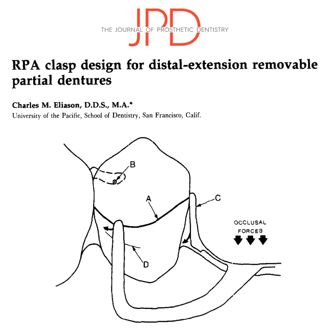 JPDentistry's tweet photo. This week on #theJPD, we highlight #removablepartialdentures. This #classicarticle describes the RPA clasp design that is an alternative to the RPI for stabilizing a #RPD with a distal extension. Learn more: https://t.co/Y63UpHURWj https://t.co/0W9q8tLmid