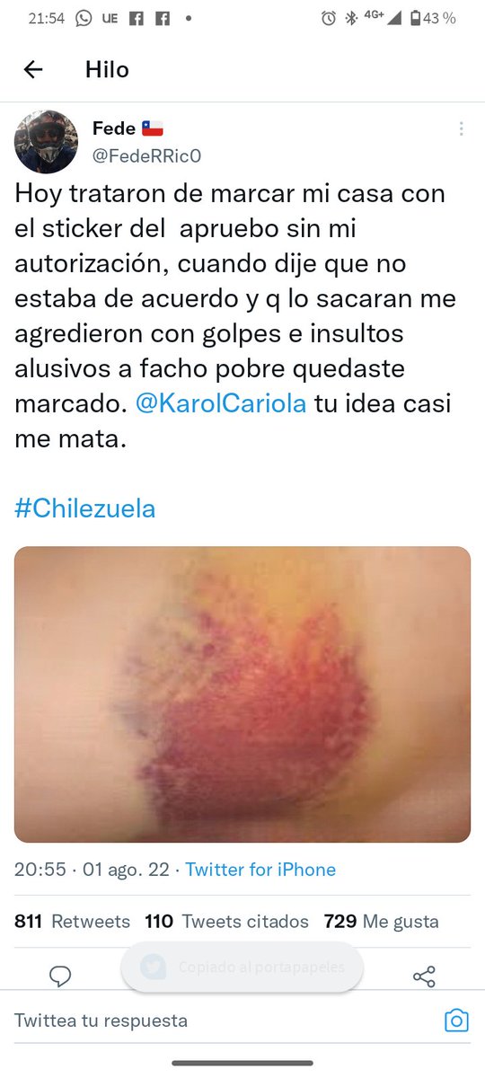 DrCmiranda2511's tweet photo. Acompañenme a ver está triste historia... Escrita por Stephen King .. https://t.co/hKHRULmery