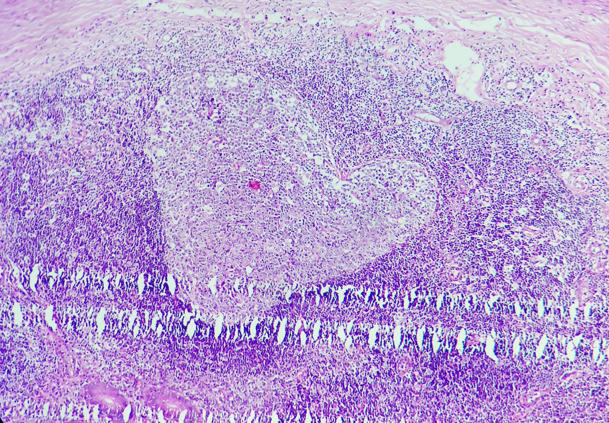 padmapathology1's tweet photo. When you truly โฅ๏ธ someone, inspite of all their imperfections ๐
#pathlove #PathTwitter https://t.co/Sef801pFiH