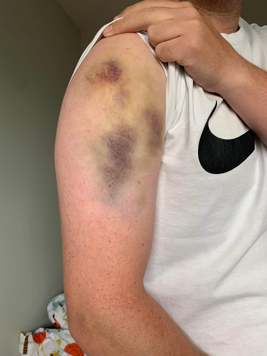 KCC1852's tweet photo. A warning to anyone playing against @ekcricket, their opening bowler is QUICK. π±
Warning to anyone playing us, donβt get your quick bowler to hit our quick bowler π Tom came back with 7-35 including a hattrick (big quick was the hattrick ballπ) ππ
#goodcricket https://t.co/7OheetDxmM