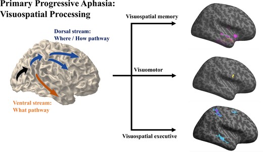 @BrainComms (@braincomms) on Twitter photo Tee et al. show that the visuospatial cognitive phenotypes of primary progressive aphasia (PPA) are associated with anatomical changes over the right hemisphere, albeit the structural changes of PPA are most evident over the left hemisphere. bit.ly/3PRymTr <a href="/UofCalifornia/">University of California</a> Tee et al. show that the visuospatial cognitive phenotypes of primary progressive aphasia (PPA) are associated with anatomical changes over the right hemisphere, albeit the structural changes of PPA are most evident over the left hemisphere. bit.ly/3PRymTr <a href="/UofCalifornia/">University of California</a>