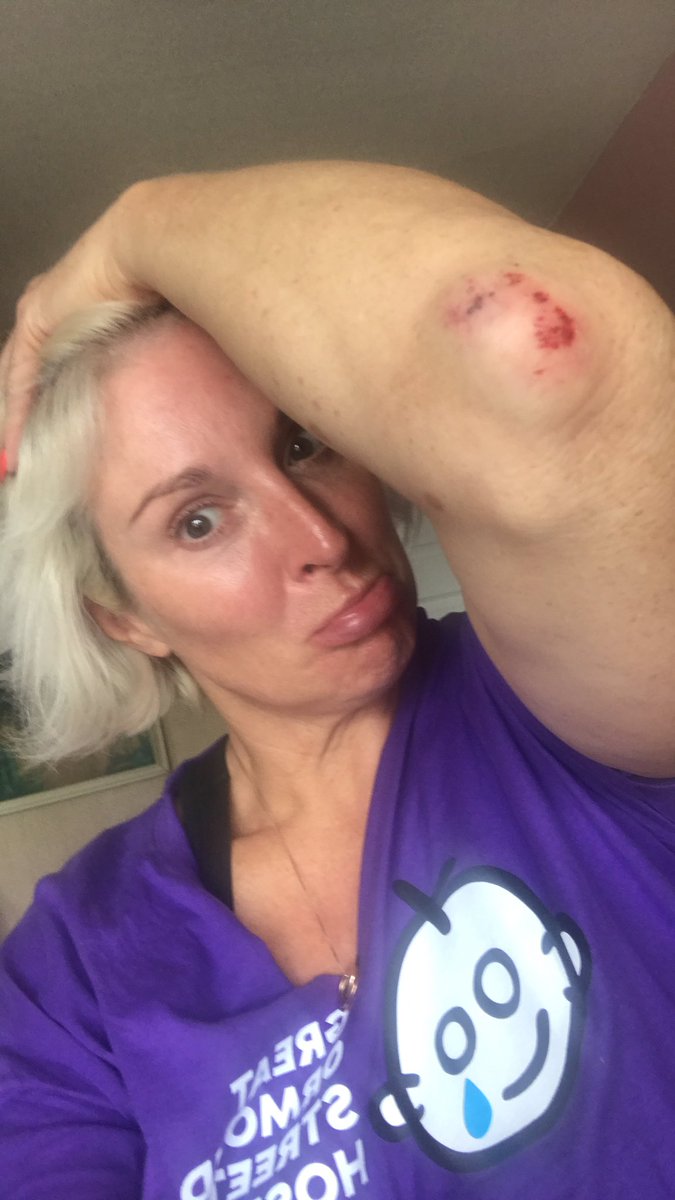 LaserLoungeUK's tweet photo. @jamesmartinchef Tidy !….. morning James I’m doing 50k on my skates in august for  @GOSHCharity , have my 1st injury …. Need one of your Rosey apples  to make me better 🥰 https://t.co/SsyqfTAmRm