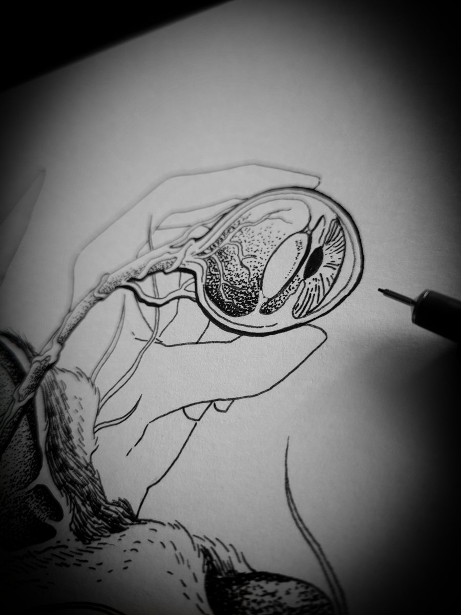 wrongsideart's tweet image. Have you ever seen how wooden stick poke the eye so badly that the stuff what's in the eye leaks out and how medical technology can replace all the parts and save the eye..... 
I have.