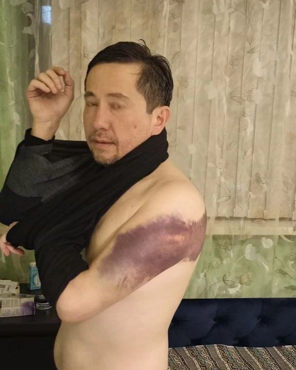 Ardak_Bekten's tweet photo. 3/10
gave evidence.  Almost 7 months have passed since the torture, but not a single employee has been held accountable for torture.  Moreover, not a single employee has even been recognized as a suspect - the employees of the TDF are witnesses.
 Investigator #Mustafin A.M. https://t.co/HoAPdF8Woi