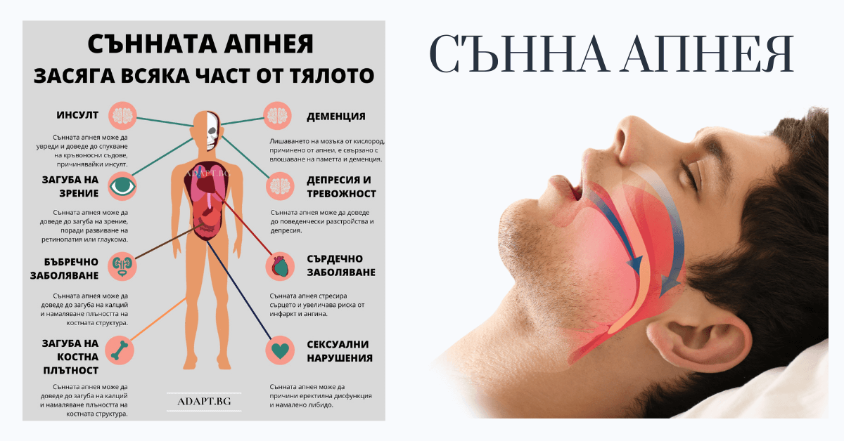 AdaptBG's tweet photo. Излекувах се от сънна апнея: лична история

https://t.co/eDSIb29Rba

#sleepapnea #съннапнея https://t.co/tLaRwIubLx