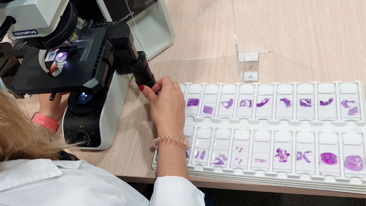 HospitalSantPau's tweet image. 🔝 El Servei d’Anatomia Patològica de #SantPau amplia l’acreditació de l’#ENAC per a l’estudi histopatològic de biòpsies de patologia tumoral primària d’os i parts toves 👇🏻
santpau.cat/web/public/com…