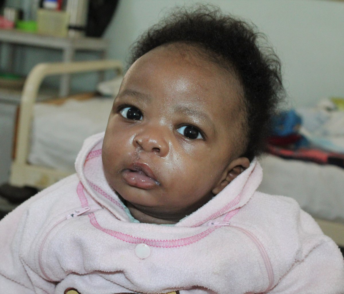 corsuhospital's tweet photo. #ComprehensiveCleftCare is one of our major goals.
Children like Kalule are able to receive #surgery, nutrition rehabilitation, #nursingcare, speech & language #therapy among others at no cost.
Thanks @Smiletrain & @TransformFaces for fully subsidizing cleft care. #ccc #cleft https://t.co/I3bSZ6gQ65
