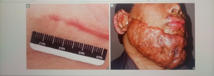 GazafJ's tweet photo. hey guys, what's the name of this condition ? Fig B looks familiar - we once posted about it. Let's go, tell me all that you know ! 🙇🏾♂️
#dr_jibril
#we_are_learning https://t.co/3rFvQy10WY