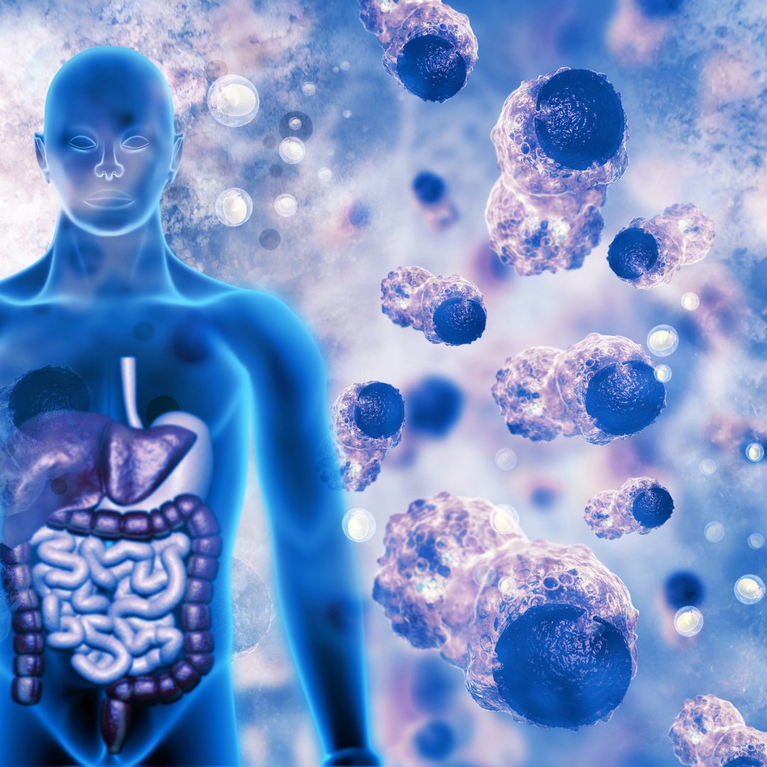 Alliedgrp's tweet photo. New Discovery Could Lead to Improved Cancer Treatment.

Read More: https://t.co/GVqTdiPW3K

#cancerresearch #Tcells #cancertreatment #immunotherapy #research #healthcare #alliedgrp https://t.co/ejALNdjIMd
