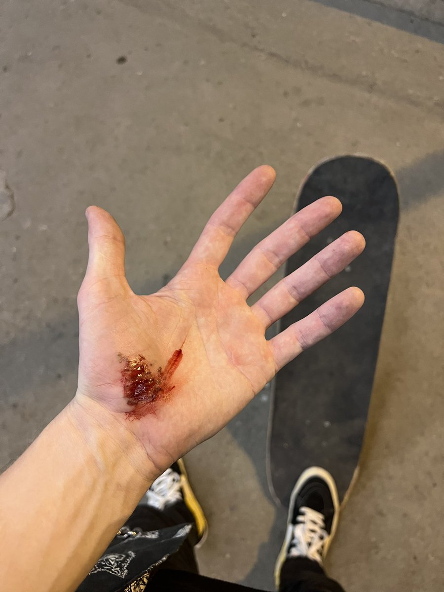 Я люблю все свои шрамы 
И хочу заработать новых