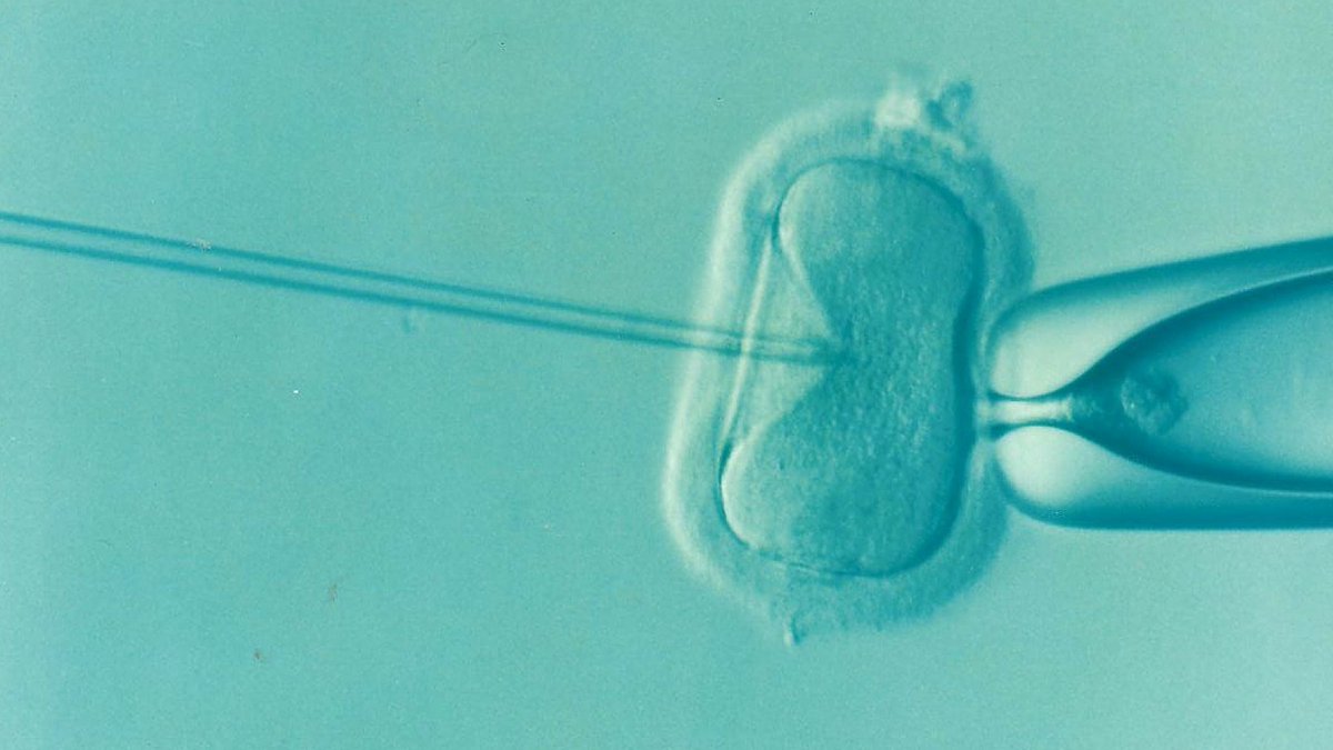 PET_BioNews's tweet photo. Does advanced paternal age influence #IVF live birth rates?  
New research presented at the @ESHRE annual meeting shows a significant results. Find out more about this interesting research in BioNews: https://t.co/pXHYRu57dV
#ivf #maleinfertility #ttc #fertility #paternalage https://t.co/LvgAwjYiPF