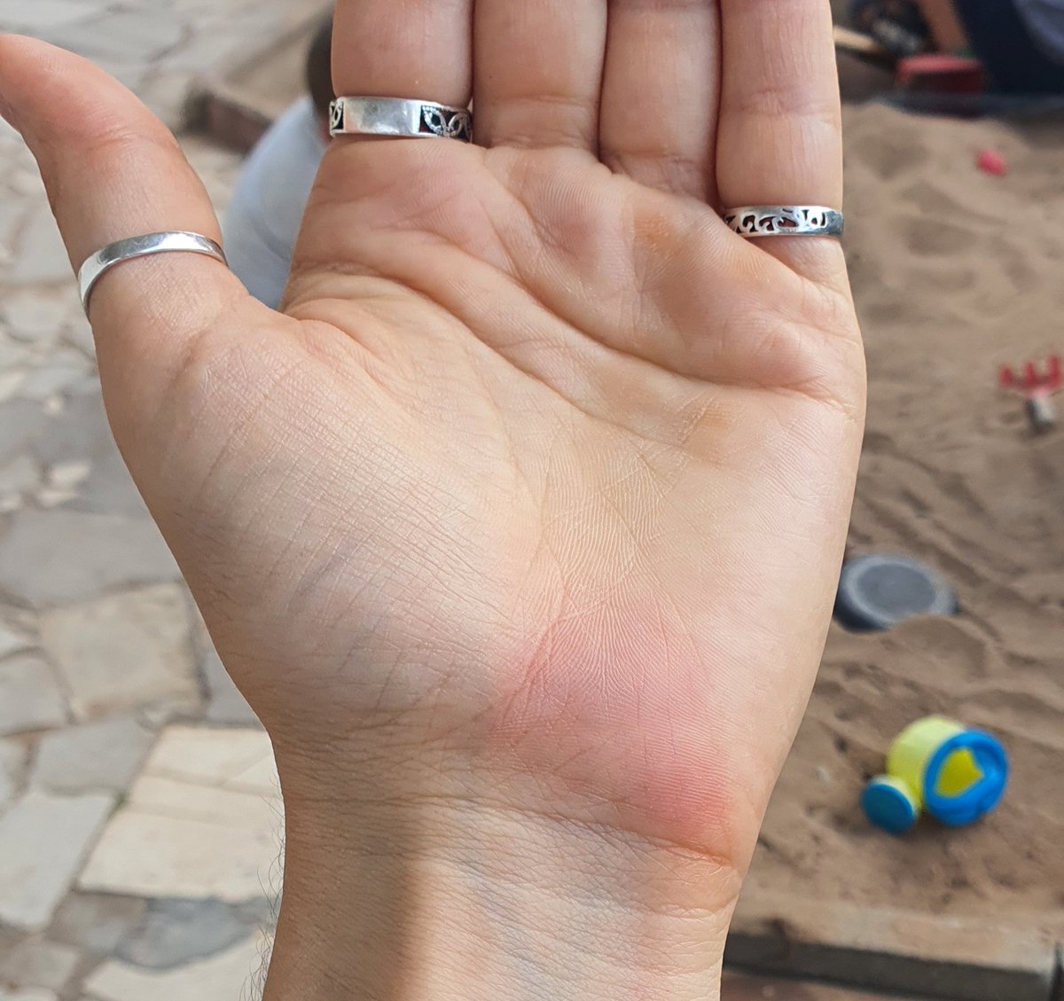 MichelleETenner's tweet photo. Beim putzen am #Autositz verbrannt 😵🥴
Bitte lasst bloß niemanden (👶🧒🏼👧🏼🐕) im #Auto ... ist mega heiß da drin, selbst mit geöffneten Fenstern.🌡 https://t.co/6p5hUPOKSp