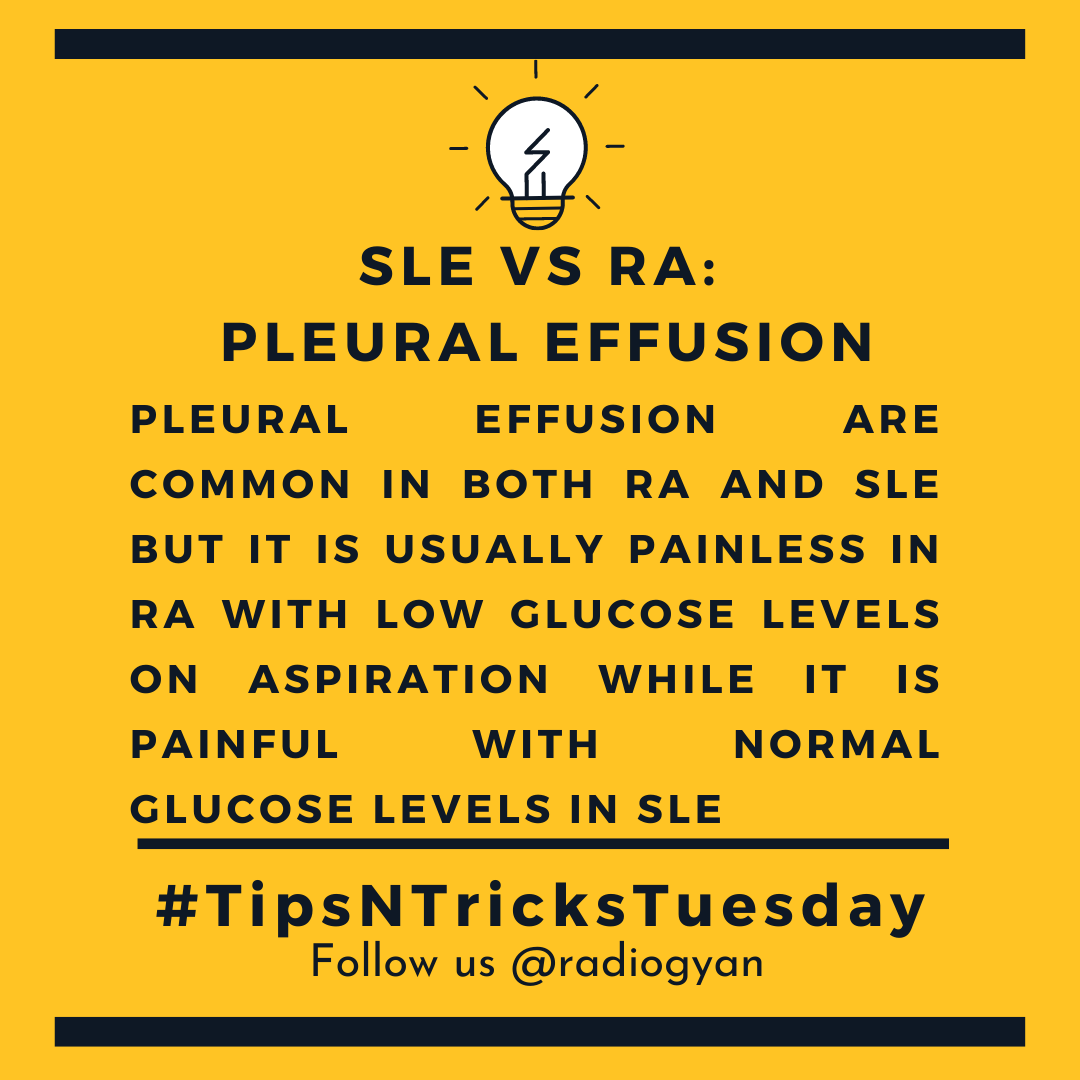 TeamRadioGyan's tweet image. #TipsnTricksTuesday 

Here is a pearl about SLE vs RA: Pleural effusion
 
All credits to #TeamGyan member Dr. Dev.
Follow him on Instagram @drdevrad for more.
 
#pleural #thoracic #sle #ra 
#radiogyan #studygram #study #learning #radiology #radiologist