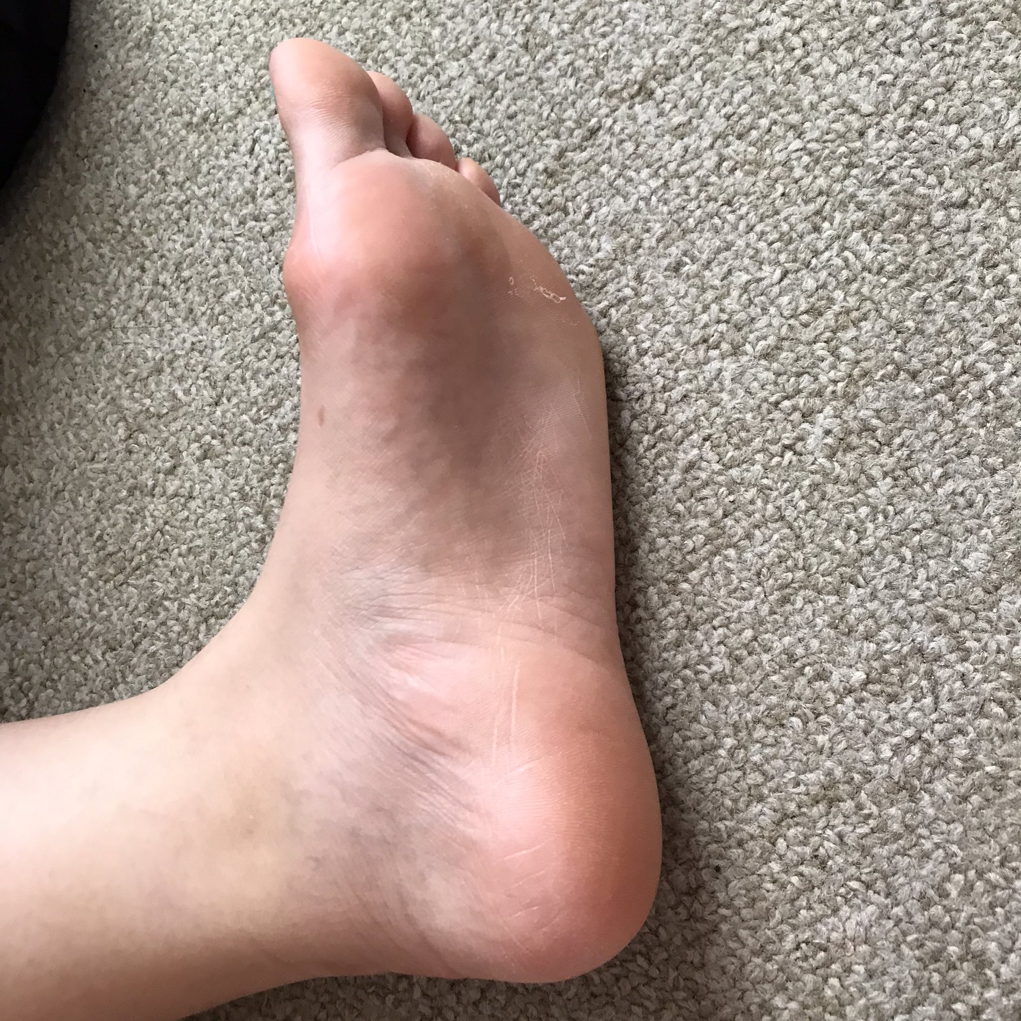  On Twitter footfetish teamprettyfeet 
