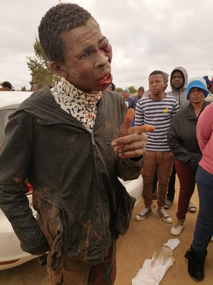 StillChardonnay's tweet photo. @Solphendukaa After fighting for you like this you're just gonna act like awazi niks? https://t.co/y5cKQ9P1qf