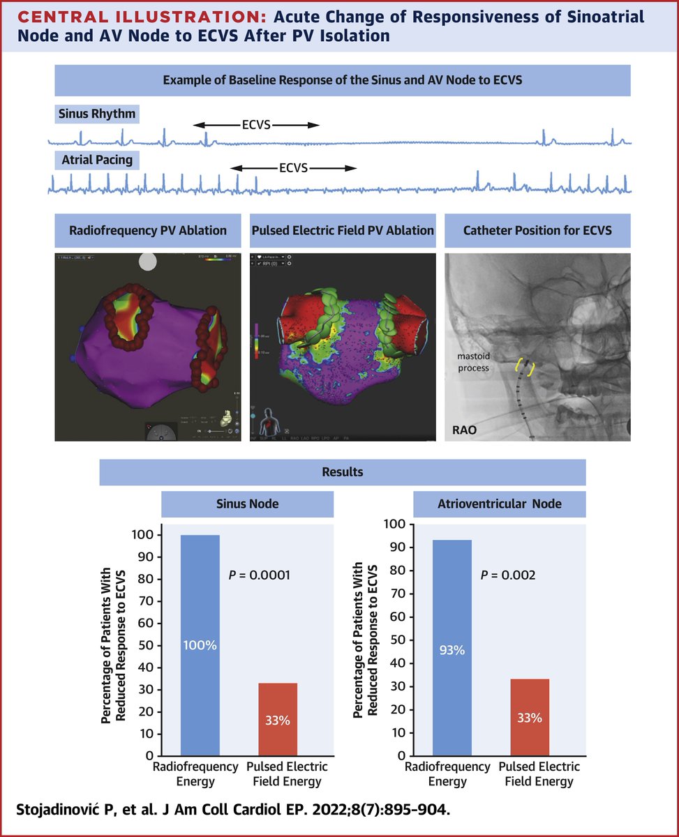 Pulsed Field Ablation (PFA) holds great promise as a novel ablation energy. Read these important observations regarding the durability of autonomic changes of PFA vs standard RF. bit.ly/3PSyUsd

#JACCCEP #EPeeps #CardioTwitter