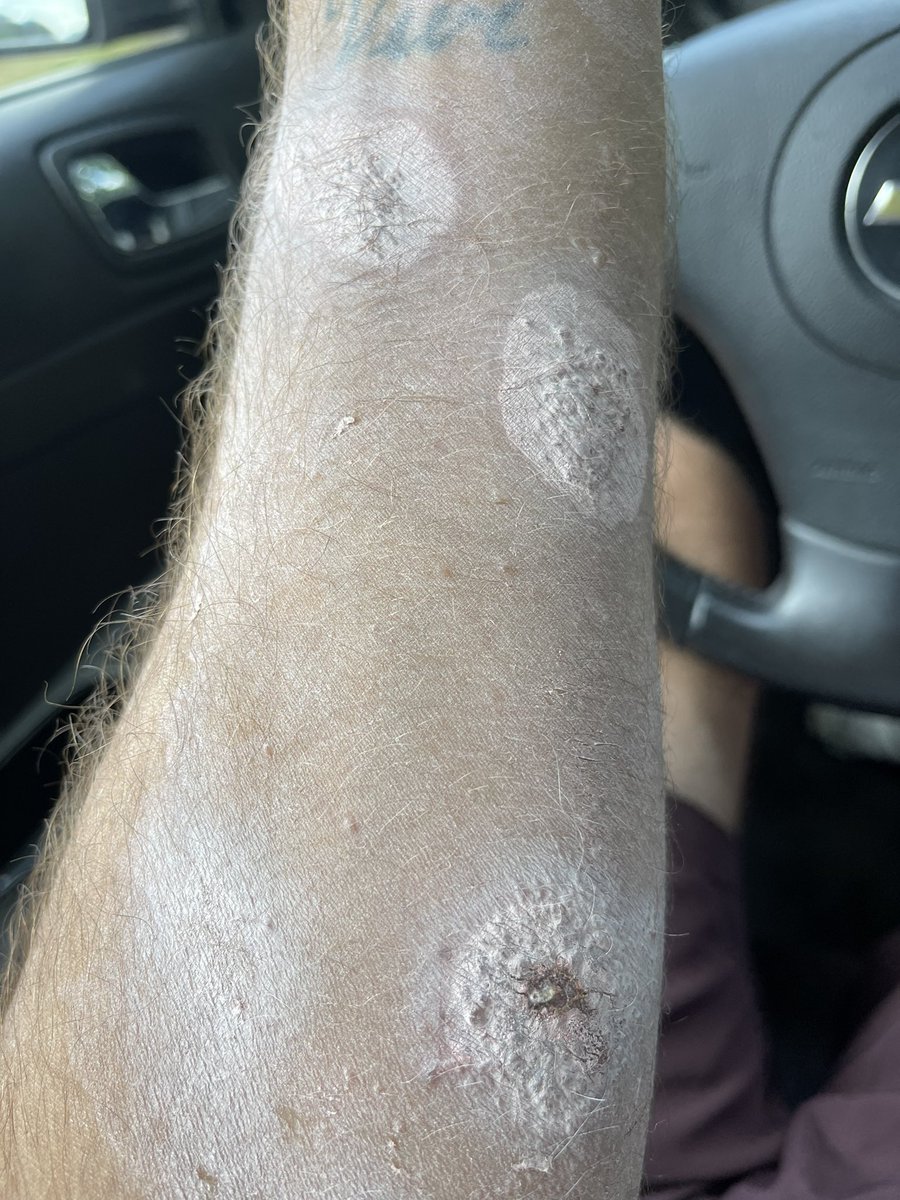 Fiber Woods . tweet media