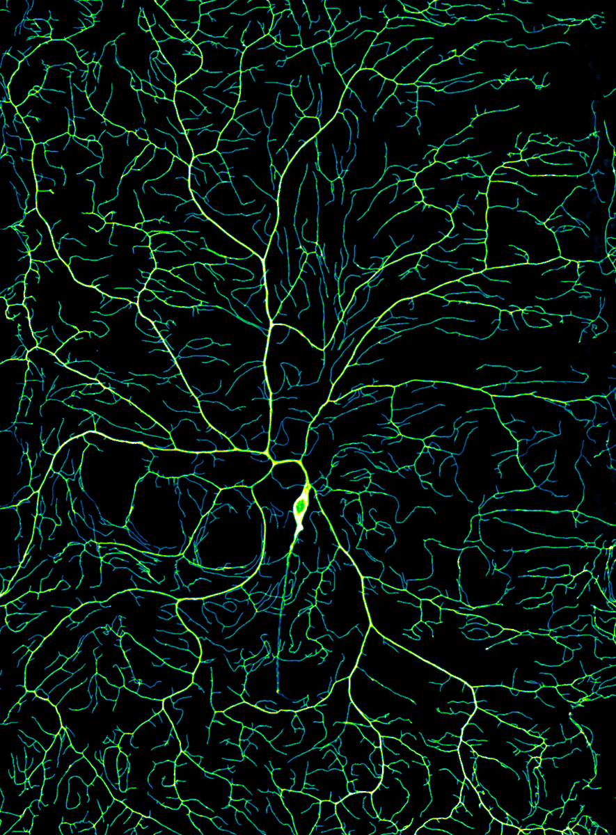 IzzyBackman's tweet photo. When the brain develops, the nervous system branches out in a beautifully intricate, yet poorly understood, way that allows neurons to send messages throughout the body. Now, researchers have found the mechanism behind this growth
My latest for @YaleMed 
https://t.co/a4Xt2YSG3Y https://t.co/u1IyWcKYnW