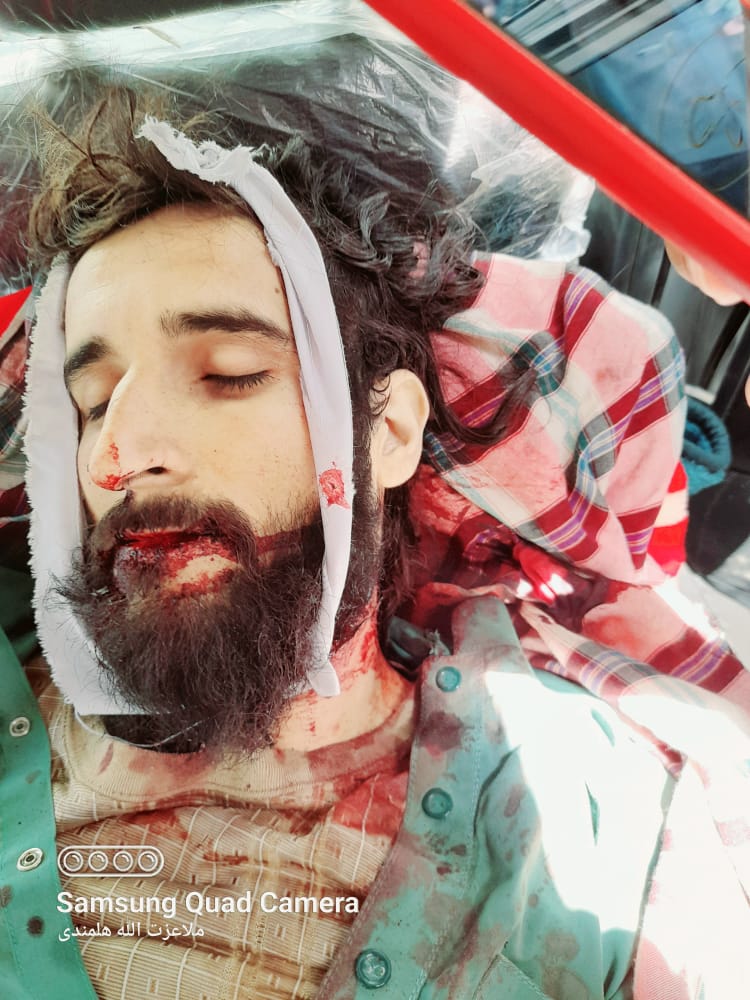 Barshor123's tweet photo. نن مو د نمروز د کنګ ولسوالۍ د دې شهيد ملګرو او نورو سرحدي مجاهدينو ته معاشونه ورکړل د د پوښتنه مو وکړه خو ملګرو يي ويل چي دۍ نه وو ثبت يعني بې معاشه عسکر وو الله تعالی دې شهادت قبول کړی 😭😭 https://t.co/G14GasjCpA