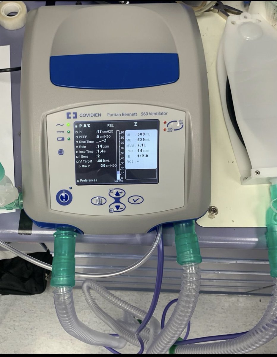 _RAS2's tweet image. I’m so proud that I saw ventilator device that was manufactured in Saudi Arabia🇸🇦, provided by Medtronic in National Gaurd Hospital , a great step for medical advance in our country and we are waiting for more in the future 🇸🇦🤍