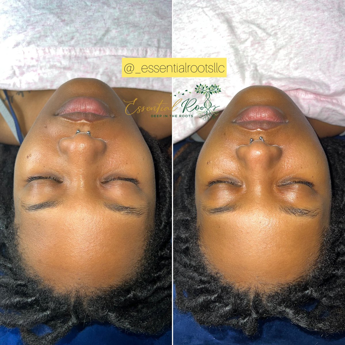 EssentialRoots's tweet photo. Facials 🧖🏾‍♀️🧖🏾 https://t.co/TG06WBl95H