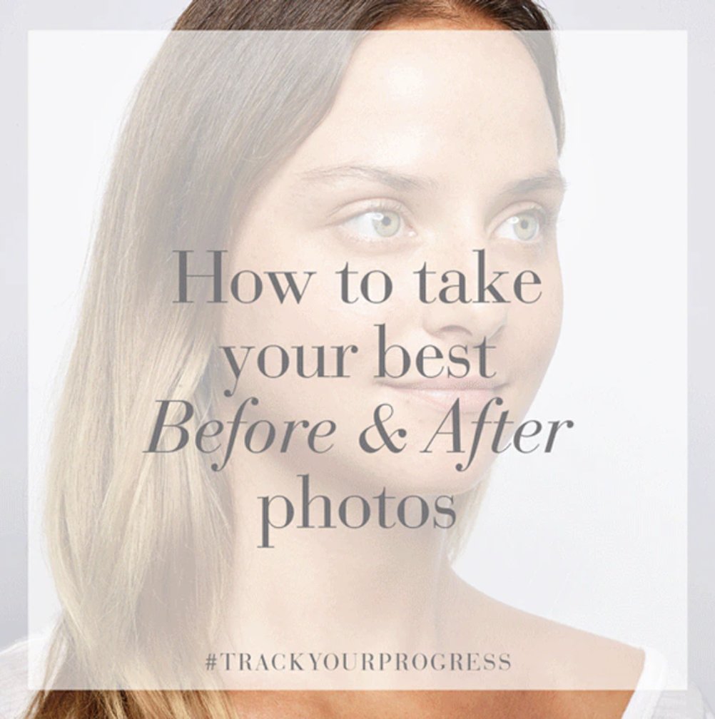 Don't know how to take picture-perfect before + afters? Don't worry, we've got you covered. 
Read more to get tips on how to get ready for your close-up. 😉
