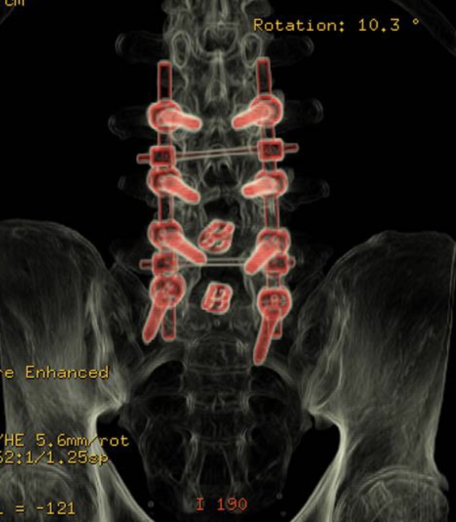 Dr. Raul Rincon-Navarro (@dr_raulrincon) / Posts / X