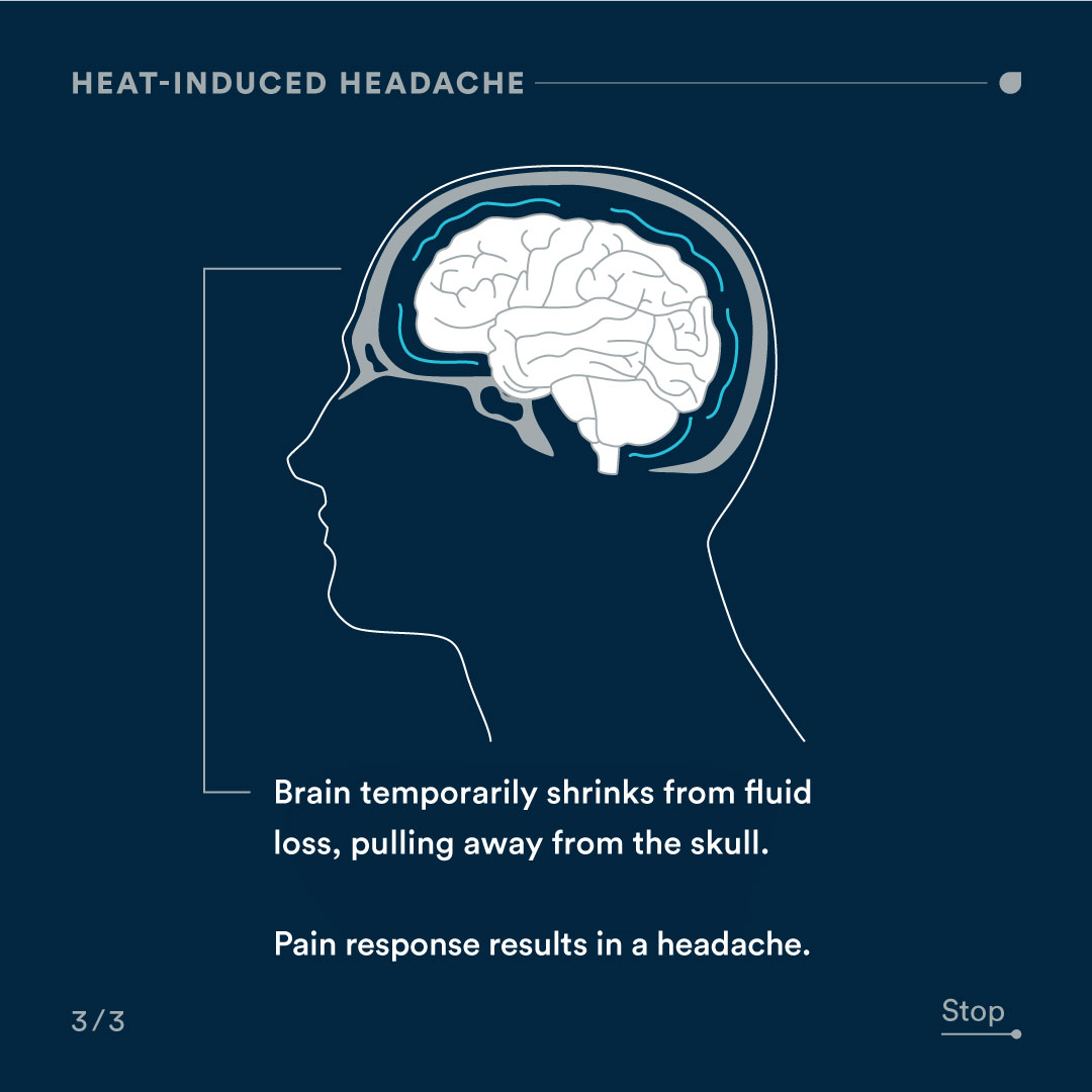 Heat-induced headaches: the dull, throbbing ache that intensifies as temperatures rise 🥵 When it's hot, your body loses water/electrolytes as you sweat. The blood vessels in your brain narrow and the brain slowly pulls away from the skull, resulting in a headache. #dehydration