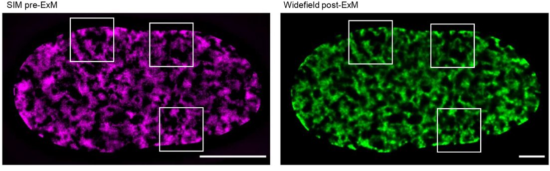 For #TechnicalTuesday we highlight a method in the current JCS issue for imaging nanoscale nuclear structures with expansion microscopy by <a href="/nedmcneelysson/">Rob Neely</a> @Morris_Lab_DSBs &amp; co.

journals.biologists.com/jcs/article/13…