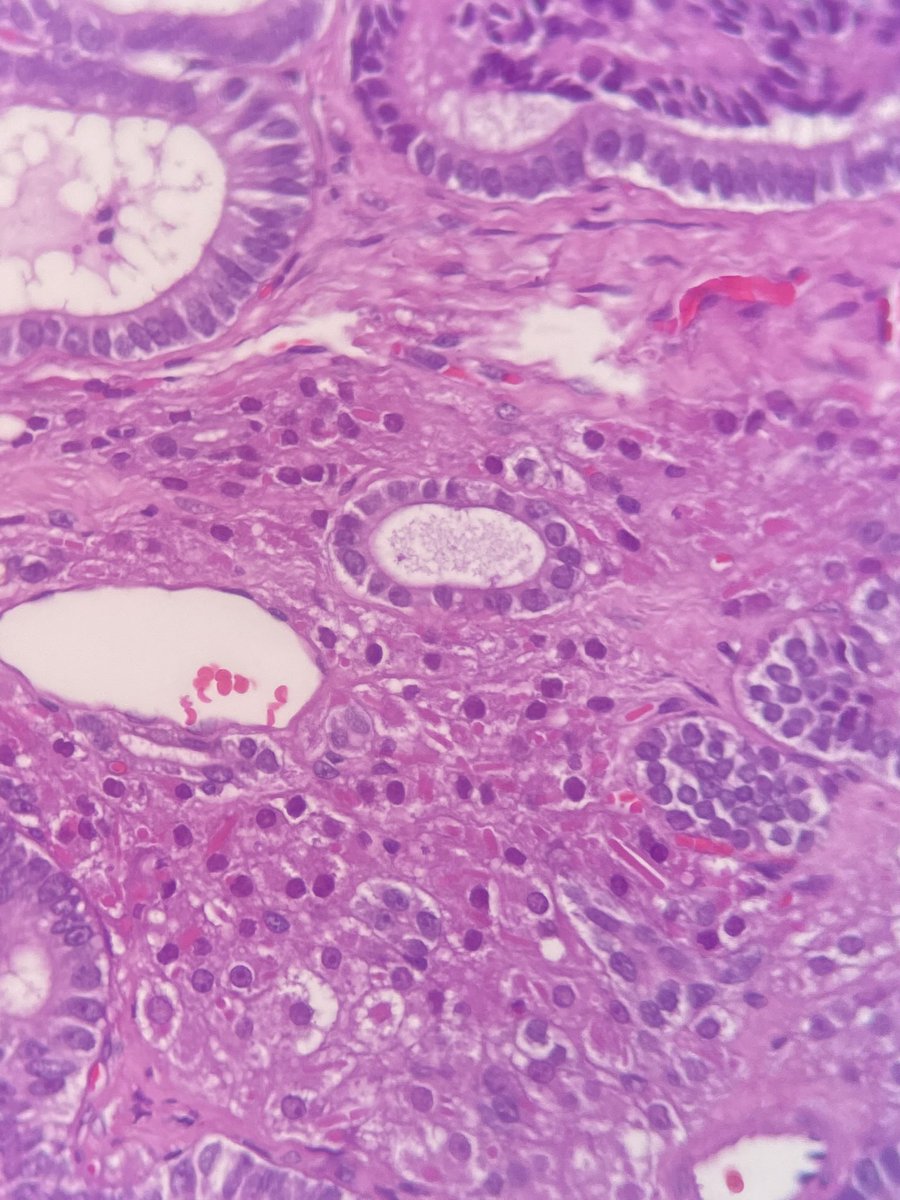 One spot diagnosis 

#gynPath