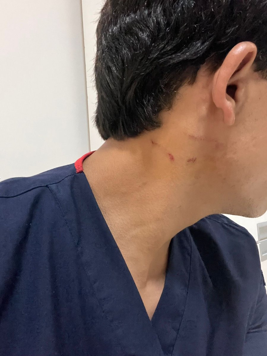 ailenizinasist's tweet photo. Bu gece 23.30 civarında Gaziantep Üniversitesi acil yeşil alanda doktor bir arkadaş ayaktan gelen hastaya sonuçlar çıkana kadar bekleme salonunda bekleyebilirsiniz dedikten sonra hasta doktora küfür edip yumruk attı ve öldürmekle tehdit etti + https://t.co/m8EqJVHFvj