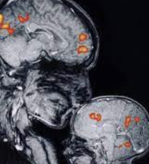 ecalixto's tweet photo. El primer beso, el primer día de clases, un viaje, el primer auto, recuerdos que se quedan en la memoria  tienen huella en nuestro ADN neuronal: se acetilan proteínas de nuestro material genético, nunca los vamos a olvidar.
#NeuroTuit https://t.co/TEXkIPPqA1