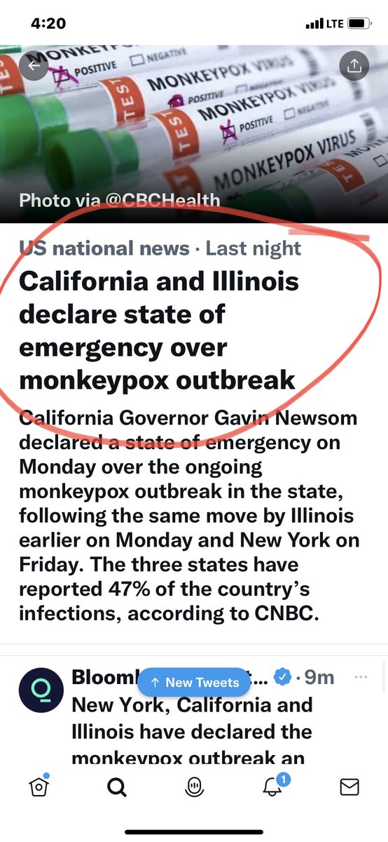 Monkey Pox is spreading because of the Gay community and both cities are in Blue states.
