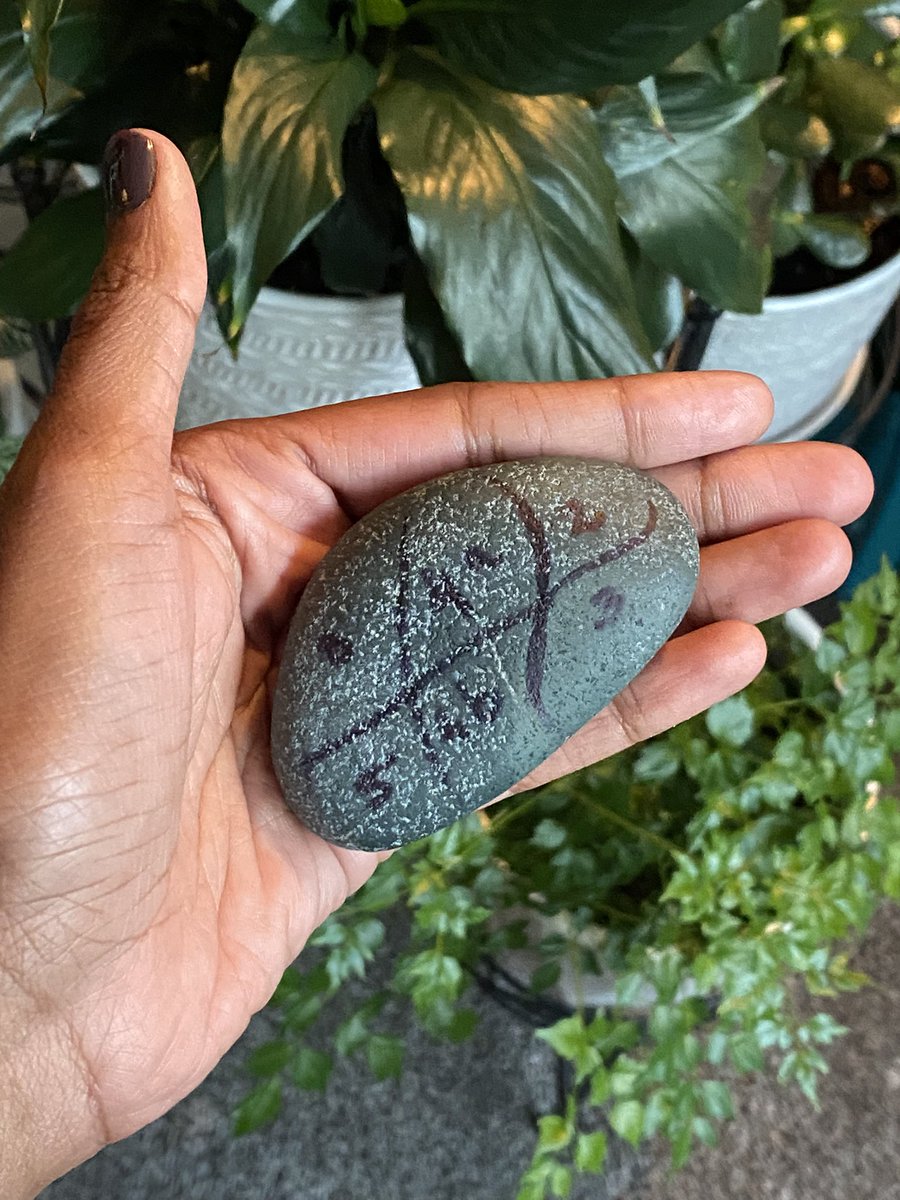 Liver segments anterior to the right hepatic vein #Radiology