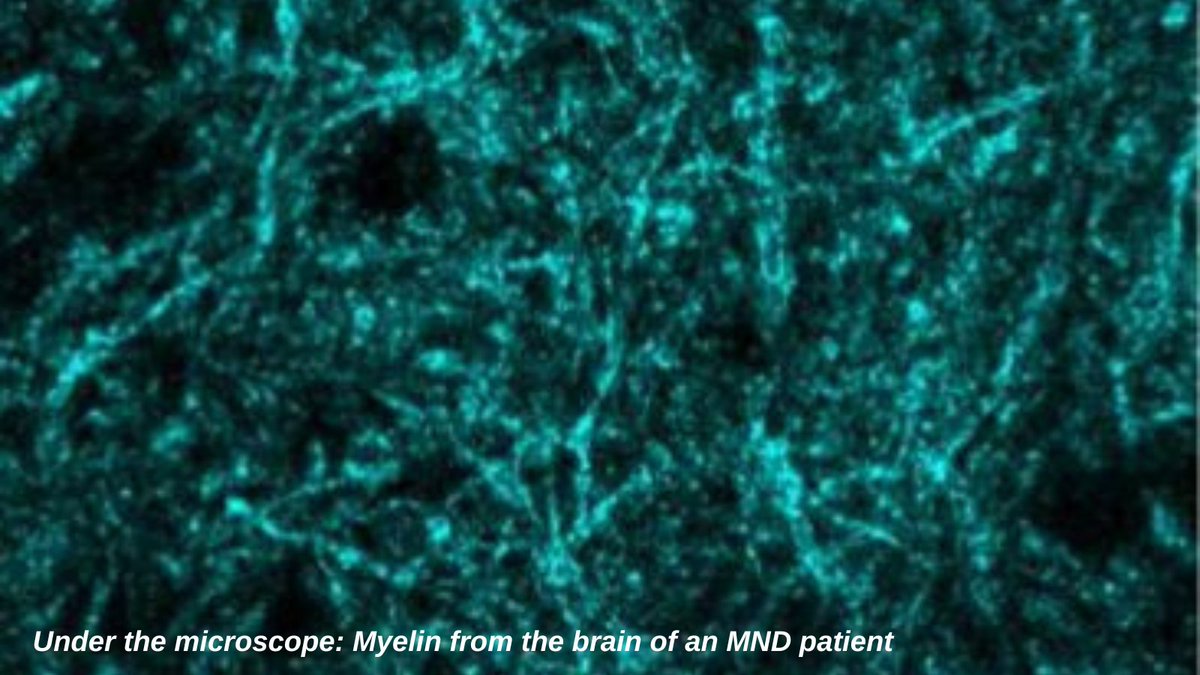 The Florey (@theflorey) on Twitter photo Research by Dr <a href="/samkbarton7/">Dr. Samantha Barton</a>, A/Prof <a href="/turnerMNDlab/">Brad Turner</a> and our #MotorNeuroneDisease team investigates oligodendrocytes, a cell type potentially contributing to disease progression which could act as a future drug target for #MND.
📖 ow.ly/2Jyf50Ka9yM
🔬 doi.org/10.3390/metabo… Research by Dr <a href="/samkbarton7/">Dr. Samantha Barton</a>, A/Prof <a href="/turnerMNDlab/">Brad Turner</a> and our #MotorNeuroneDisease team investigates oligodendrocytes, a cell type potentially contributing to disease progression which could act as a future drug target for #MND.
📖 ow.ly/2Jyf50Ka9yM
🔬 doi.org/10.3390/metabo…