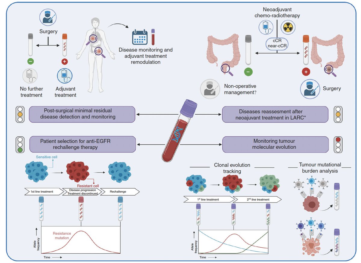 Arndt Vogel (@arndtvogel) on Twitter photo 👏Excellent review on Liquid biopsies to monitor and direct cancer treatment in colorectal cancer! <a href="/BrJCancer/">British Journal of Cancer</a>
doi.org/10.1038/s41416…
👉Ongoing trials will define the impact of ctDNA for decision making in #CRC
<a href="/myESMO/">ESMO - Eur. Oncology</a> <a href="/OncoAlert/">OncoAlert</a> 👏Excellent review on Liquid biopsies to monitor and direct cancer treatment in colorectal cancer! <a href="/BrJCancer/">British Journal of Cancer</a>
doi.org/10.1038/s41416…
👉Ongoing trials will define the impact of ctDNA for decision making in #CRC
<a href="/myESMO/">ESMO - Eur. Oncology</a> <a href="/OncoAlert/">OncoAlert</a>