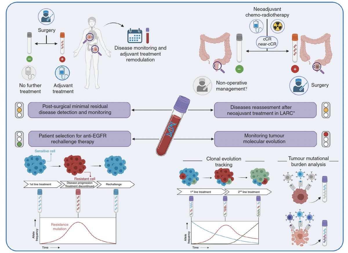 👏Excellent review on Liquid biopsies to monitor and direct cancer treatment in colorectal cancer! @BrJCancer doi.org/10.1038/s41416… 👉Ongoing trials will define the impact of ctDNA for decision making in #CRC @myESMO @OncoAlert