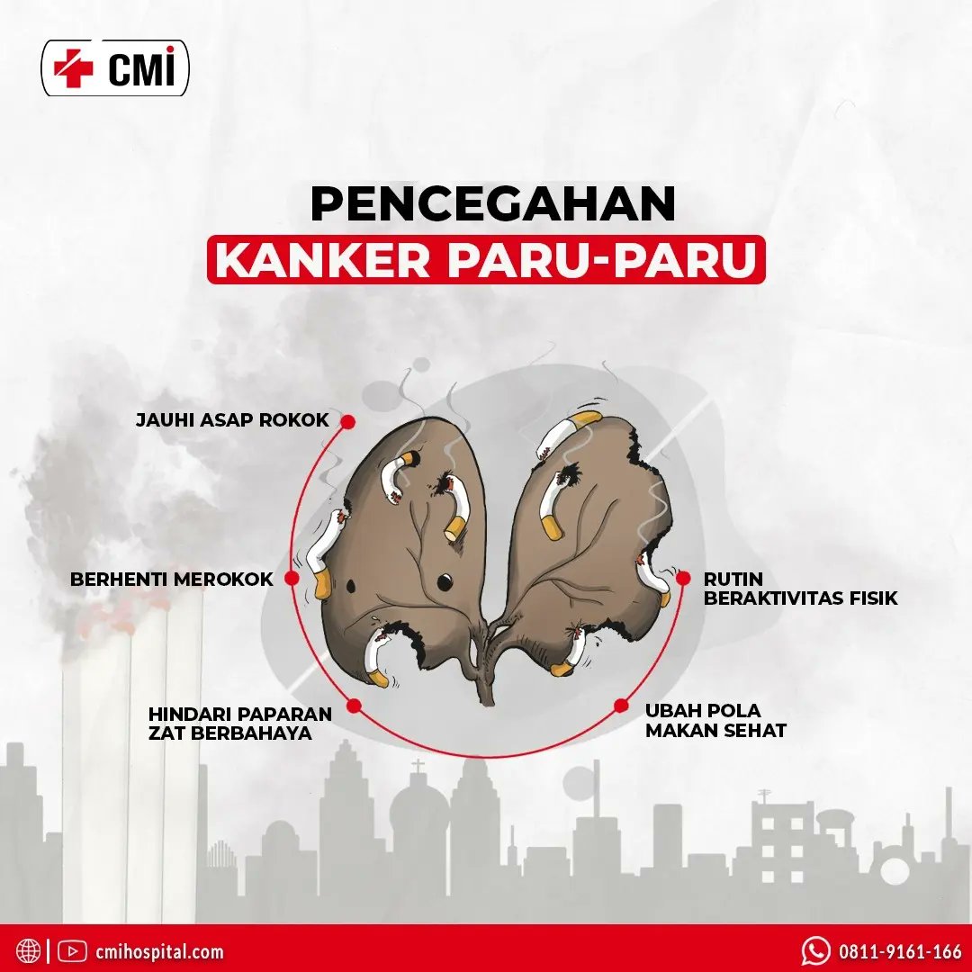 cmihospitals's tweet photo. Merokok merupakan pemicu utama terjadinya kanker paru-paru. Lalu apakah orang yang tidak merokok bisa tenang karena tidak akan mengalami penyakit ini? Tentu saja tidak! Yuk, simak info berikut ini!
#RumahSakitKanker #solusikanker #terapikanker #pengobatankanker #obatkanker https://t.co/4Upm5BTIc0