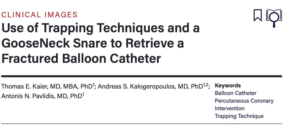 Tom Kaier (@tomkaier) on Twitter photo Lost/fractured balloon during your #PCI #CTO? Here we describe the use of trapping techniques and a snare to retrieve a fractured balloon: bit.ly/3oHsznP <a href="/InvasiveCardiol/">Journal of Invasive Cardiology</a> <a href="/AKaloger33/">Andreas Kalogeropoulos</a> <a href="/AntonisPavlidi3/">Antonis Pavlidis</a>
Includes a video outlining the steps! Lost/fractured balloon during your #PCI #CTO? Here we describe the use of trapping techniques and a snare to retrieve a fractured balloon: bit.ly/3oHsznP <a href="/InvasiveCardiol/">Journal of Invasive Cardiology</a> <a href="/AKaloger33/">Andreas Kalogeropoulos</a> <a href="/AntonisPavlidi3/">Antonis Pavlidis</a>
Includes a video outlining the steps!