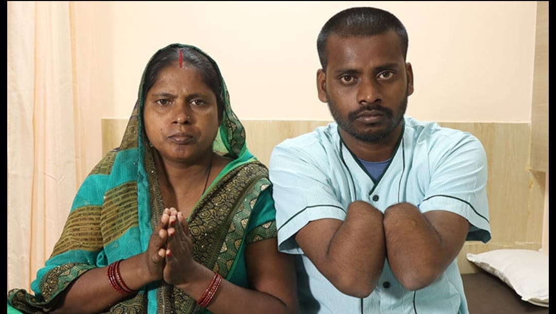 hisushank's tweet photo. @Naa_Anveshana hi anvesh bro.. please help mr. Amit. He lost both his hands. We can do hand transplant to him. Real Hands from donor will be attached to him. 12-15 such operation performed in india. Please try to help him through your network. https://t.co/n5gdnxYac9