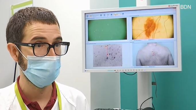 Hosp. Germans Trias (@hgermanstrias) on Twitter photo 💬 el melanoma es relaciona a persones que han patit cremades solars
✏️ <a href="/aramboada/">Aram Boada Garcia</a>, responsable de la Unitat de Melanoma i Lesions Pigmentàries, participa en un article que desmunta llegendes urbanes sobre l'exposició solar
🔎 bit.ly/3PWgJ5f a <a href="/veri_fi_cat/">Verificat</a> 💬 el melanoma es relaciona a persones que han patit cremades solars
✏️ <a href="/aramboada/">Aram Boada Garcia</a>, responsable de la Unitat de Melanoma i Lesions Pigmentàries, participa en un article que desmunta llegendes urbanes sobre l'exposició solar
🔎 bit.ly/3PWgJ5f a <a href="/veri_fi_cat/">Verificat</a>