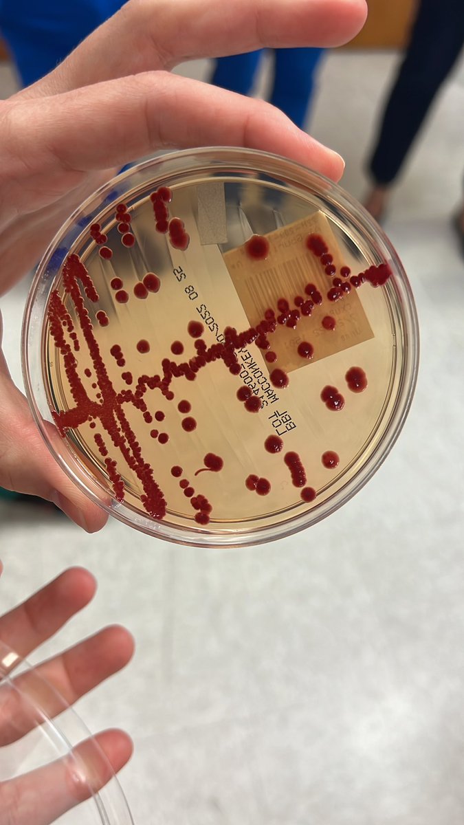 UTHealthSA_ID's tweet photo. #IDtwitter #medid #microplaterouds time at UT Health today! Check out the color on this Serratia ❤️ https://t.co/C0WobV5KHc